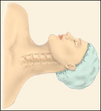 Anterior Cervical Discectomy w/ Fusion